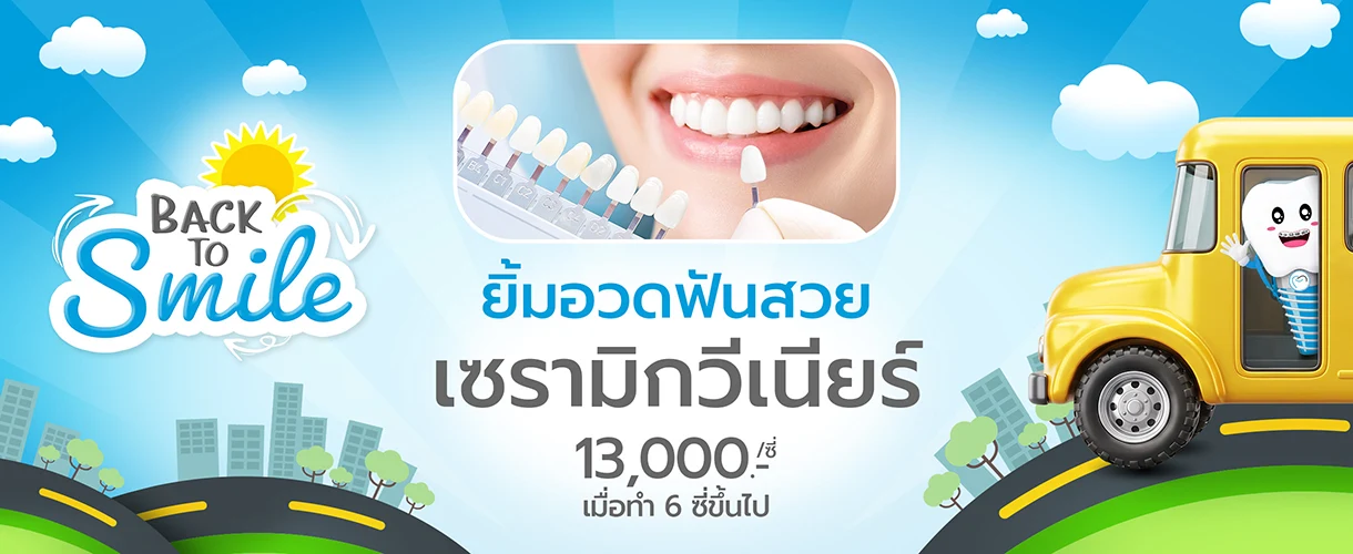 ทำวีเนียร์กี่บาท